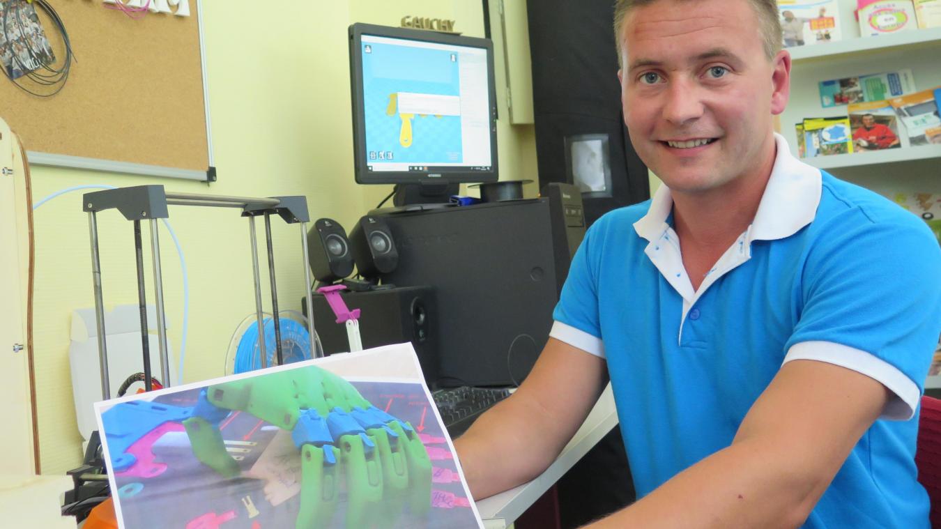 Un fablab pour imprimer des prothèses pour enfants