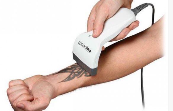 Incroyable : imprimez et effacez vos tatouages avec MoodInq