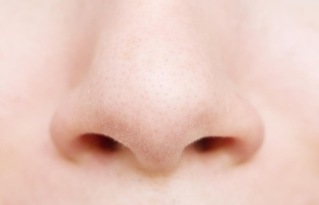 Exploit : une patiente toulousaine se fait greffer un nez imprimé